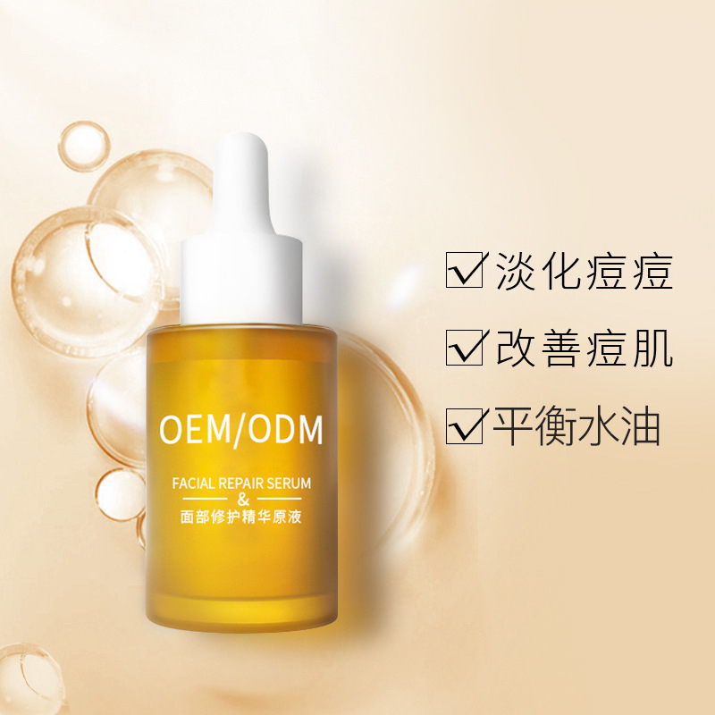 纳爱_祛痘精华原液OEM